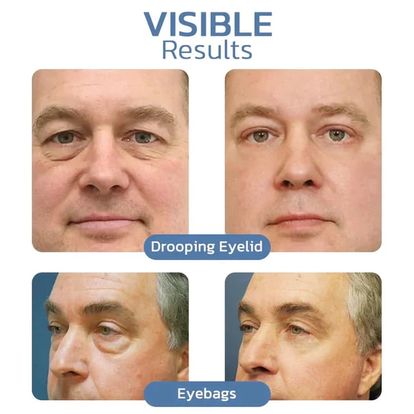 đKöp en, fĂ„ en gratisđ - Instant Firming Eye Cream