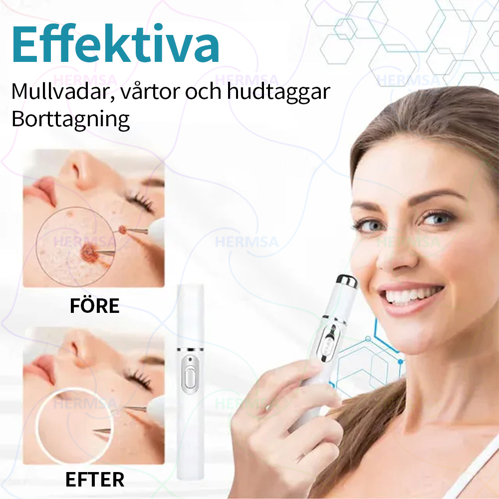 Hermsa® icke-invasiv laserpekare - borttagning av födelsemärken och vårtor