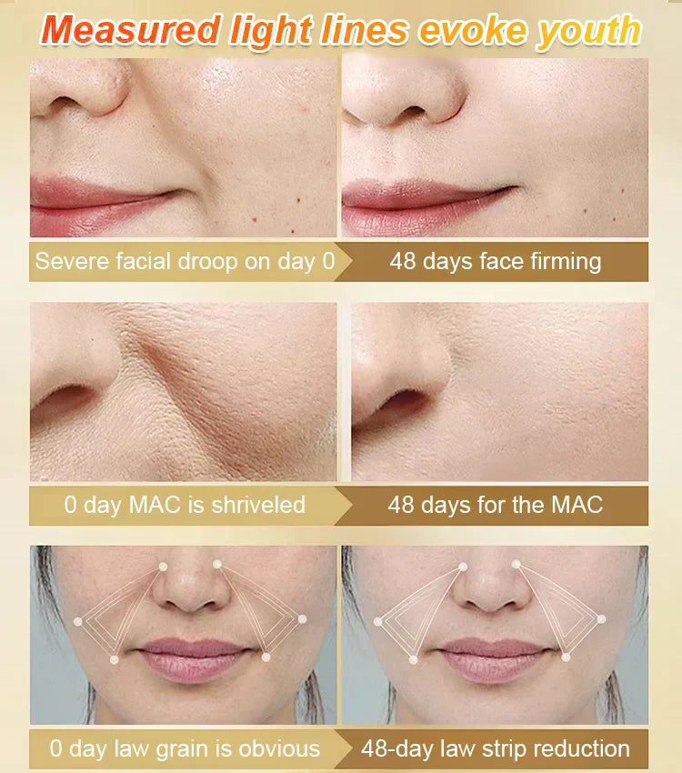 🏆Flash Sale⚡20K+ SÅLD! Nästan slut💥Uppstramande och återfuktande anti-rynk serum