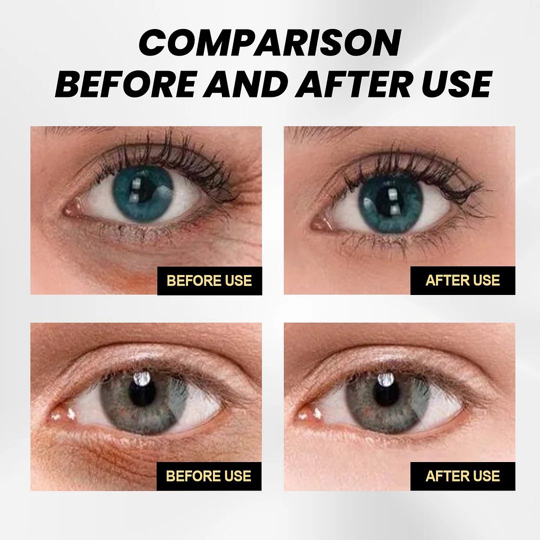 🎉Köp en, få en gratis🎁 - Instant Firming Eye Cream