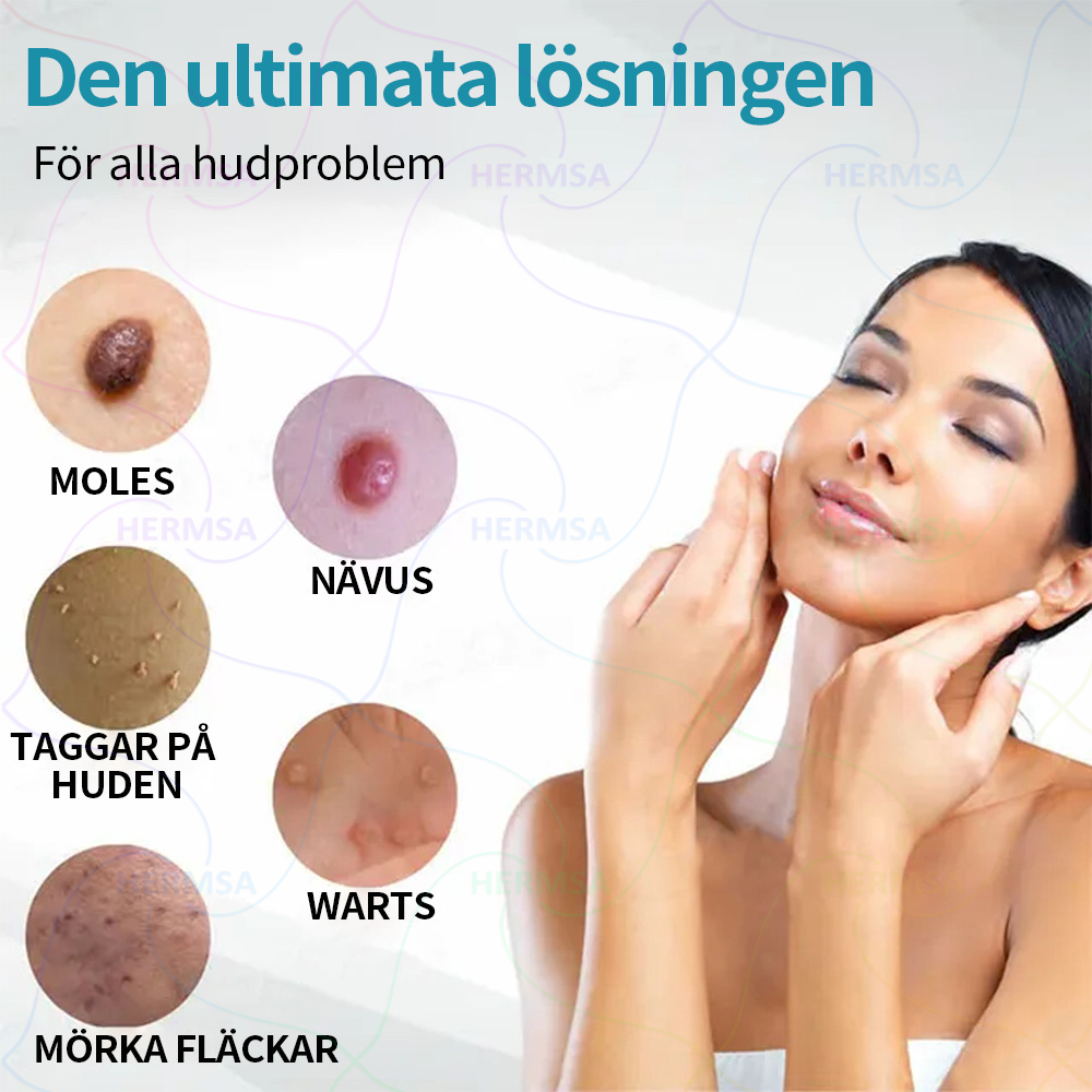 Hermsa® icke-invasiv laserpekare - borttagning av födelsemärken och vårtor